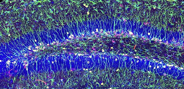 They discover the mechanism that ensures the reserve of stem cells for neuronal generation in adulthood