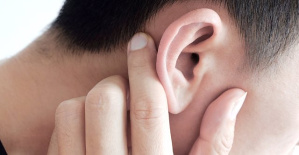 Are you able or not to move your ears? This is what science says about this 'power'